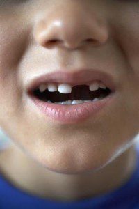 Young boy with a missing tooth