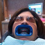 Teeth Whitening