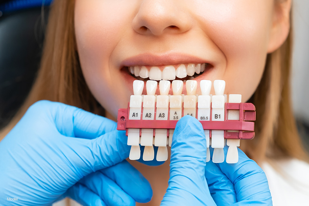 Young woman smiling against dental implants