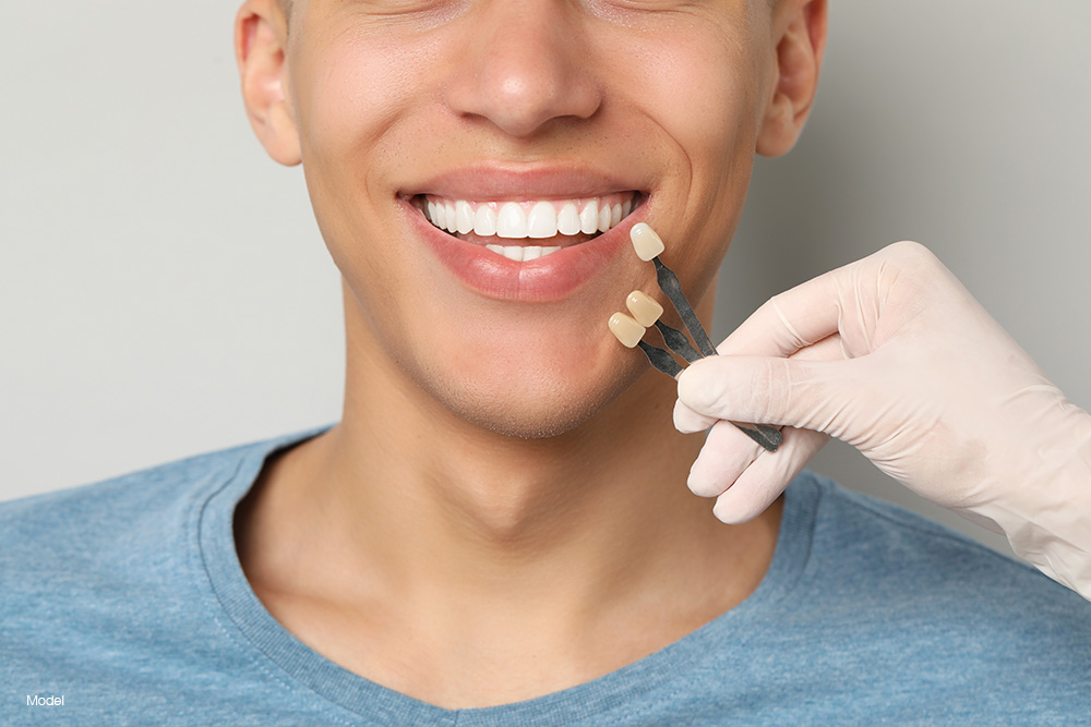 Young man with veneers smiling