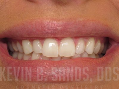 Before Image