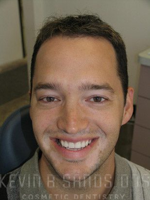 After Image