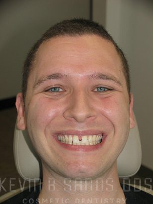 Before Image