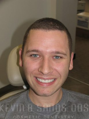 After Image